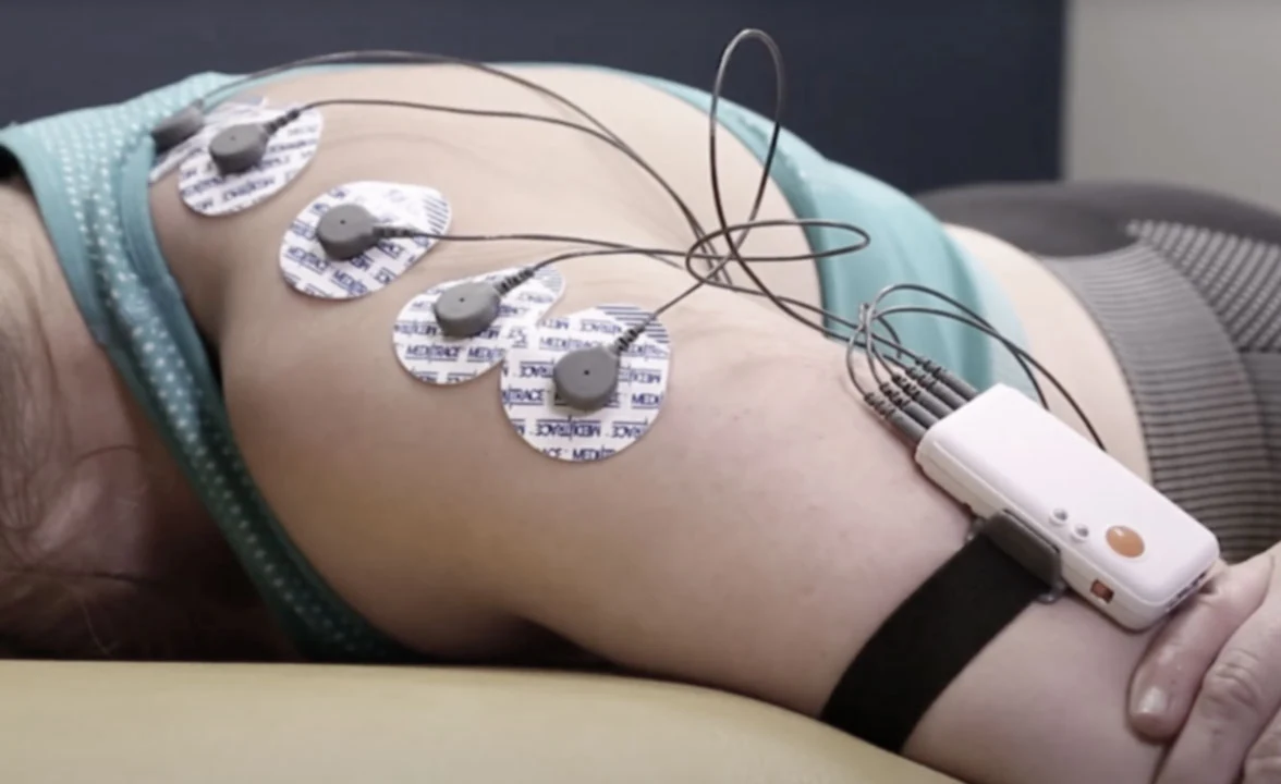 Electromiografía de superficie con electrodos